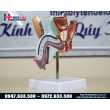 Mô hình bệnh lý hệ sinh dục nam giới
